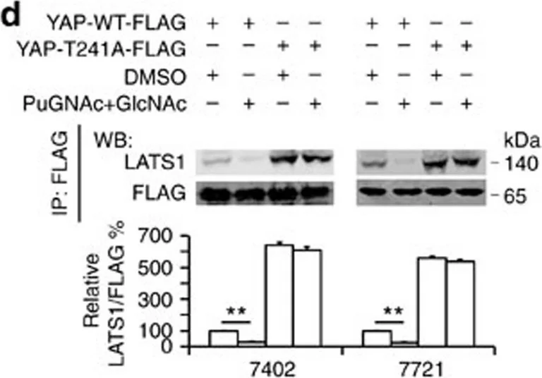 Western blot - Anti-LATS1/WARTS antibody (AB70561)