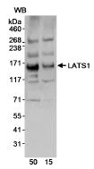 Western blot - Anti-LATS1/WARTS antibody (AB70561)