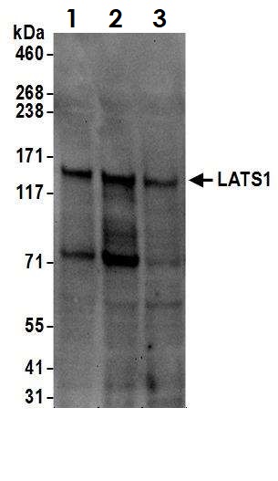 Western blot - Anti-LATS1/WARTS antibody (AB70562)