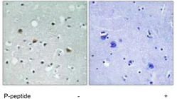 Immunohistochemistry (Formalin/PFA-fixed paraffin-embedded sections) - Anti-LATS1/WARTS ((phospho T1079) +LATS2 (phospho T1041) antibody (AB111344)