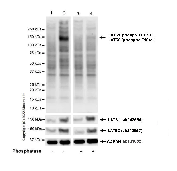 Western blot - Anti-LATS1/WARTS (phospho T1079) + LATS2 (phospho T1041) antibody [EPR27261-8] - BSA and Azide free (AB305030)