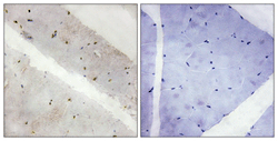 Immunohistochemistry (Formalin/PFA-fixed paraffin-embedded sections) - Anti-LATS2 antibody (AB111054)