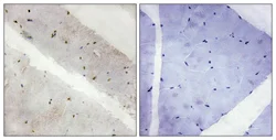 Immunohistochemistry (Formalin/PFA-fixed paraffin-embedded sections) - Anti-LATS2 antibody (AB111054)