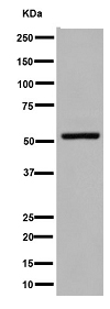 Western blot - Anti-LAYN antibody [EPR11875(2)] (AB192610)