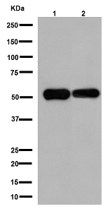 Western blot - Anti-LAYN antibody [EPR11875(2)] (AB192610)