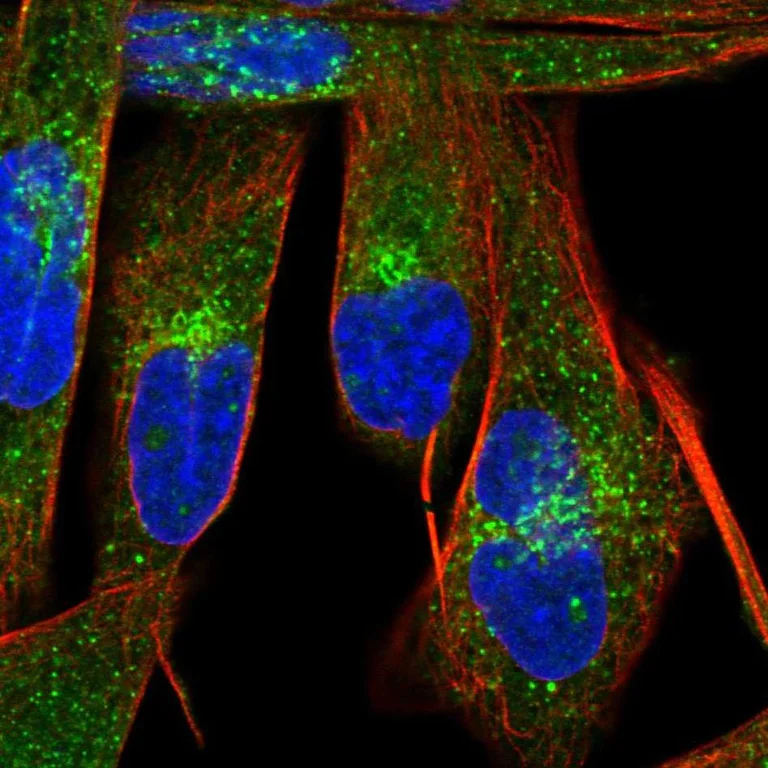 Immunocytochemistry - Anti-LBH antibody (AB122223)