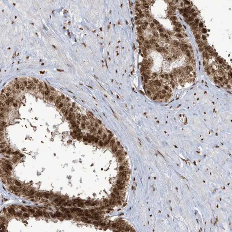 Immunohistochemistry (Formalin/PFA-fixed paraffin-embedded sections) - Anti-LBH antibody (AB122223)