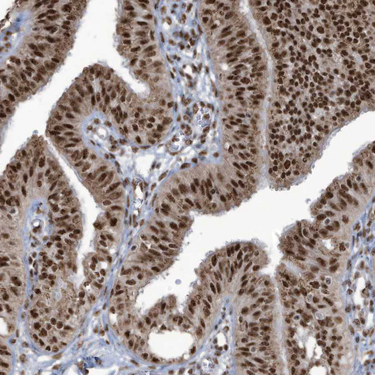 Immunohistochemistry (Formalin/PFA-fixed paraffin-embedded sections) - Anti-LBH antibody (AB122223)