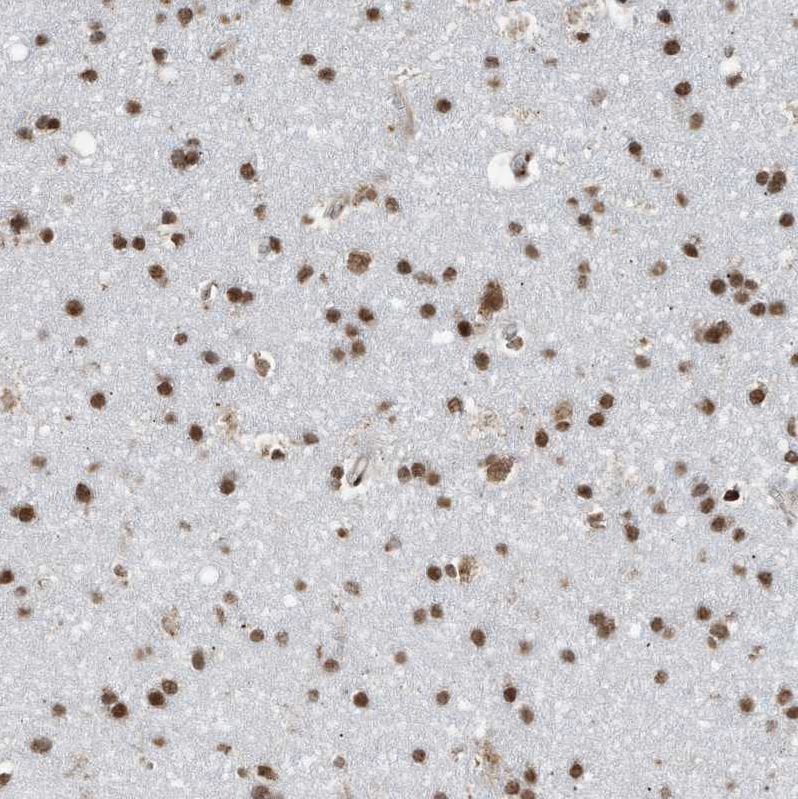 Immunohistochemistry (Formalin/PFA-fixed paraffin-embedded sections) - Anti-LBH antibody (AB122223), expandable thumbnail