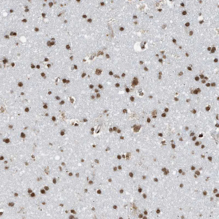 Immunohistochemistry (Formalin/PFA-fixed paraffin-embedded sections) - Anti-LBH antibody (AB122223)