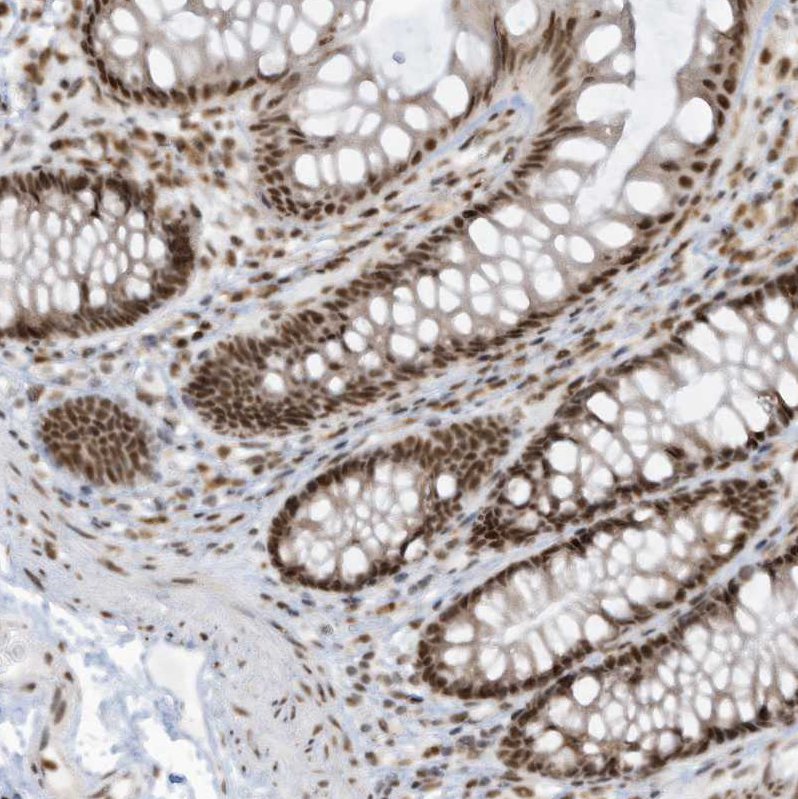 Immunohistochemistry (Formalin/PFA-fixed paraffin-embedded sections) - Anti-LBH antibody (AB122223), expandable thumbnail