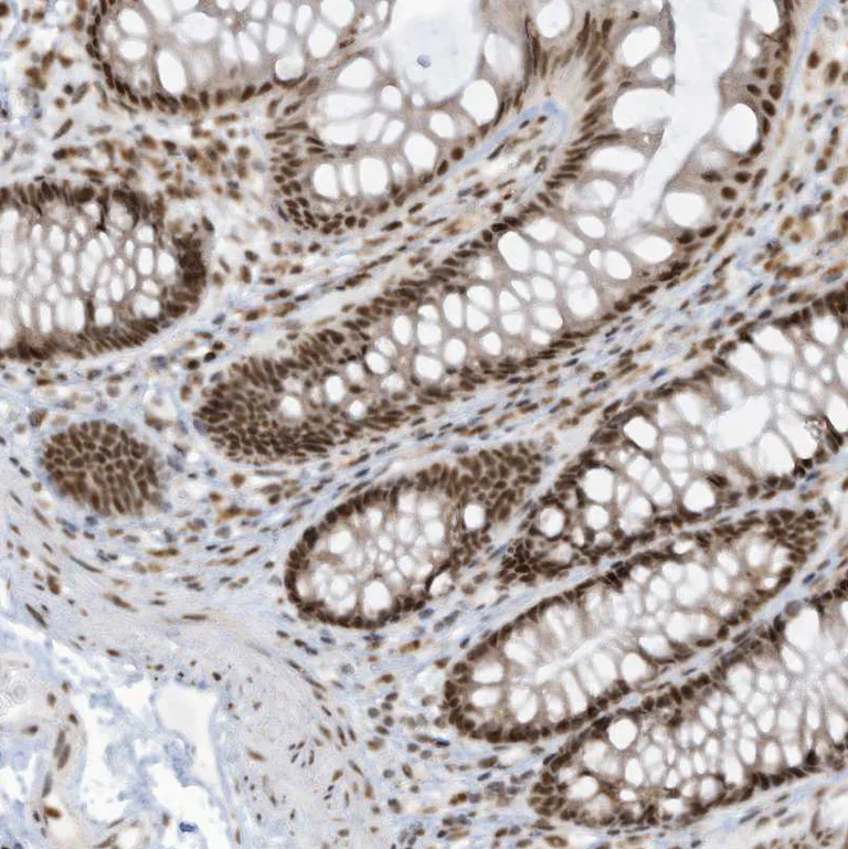 Immunohistochemistry (Formalin/PFA-fixed paraffin-embedded sections) - Anti-LBH antibody (AB122223)