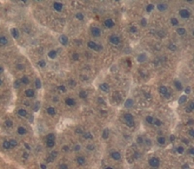 Immunohistochemistry (Formalin/PFA-fixed paraffin-embedded sections) - Anti-LBP antibody (AB231612)