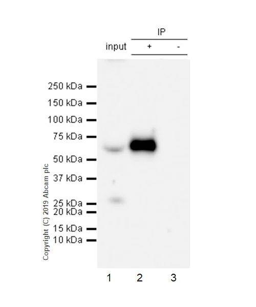 Immunoprecipitation - Anti-LBP antibody [EPR22559-261] (AB254559)