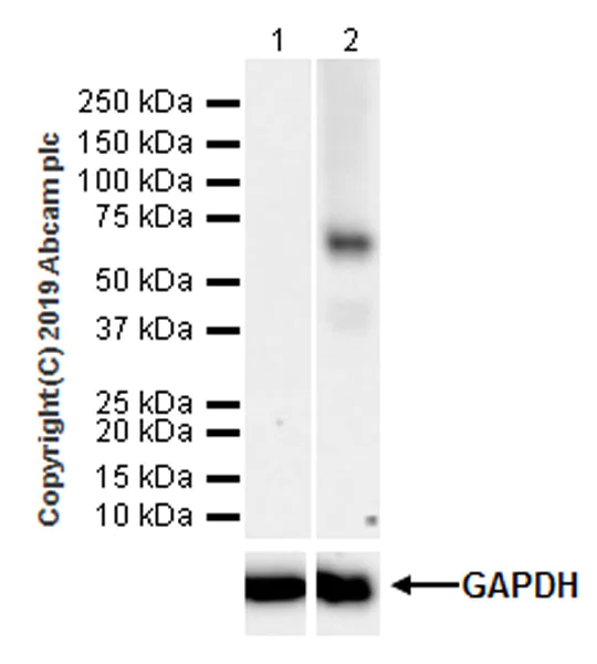 Western blot - Anti-LBP antibody [EPR22559-261] (AB254559)