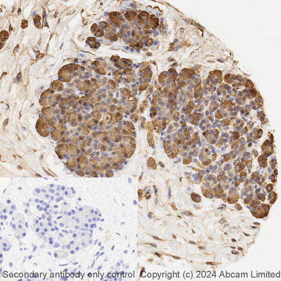 Immunohistochemistry (Formalin/PFA-fixed paraffin-embedded sections) - LBS RX - Anti-Calreticulin antibody [EPR3924] - ER Marker (AB321951), expandable thumbnail
