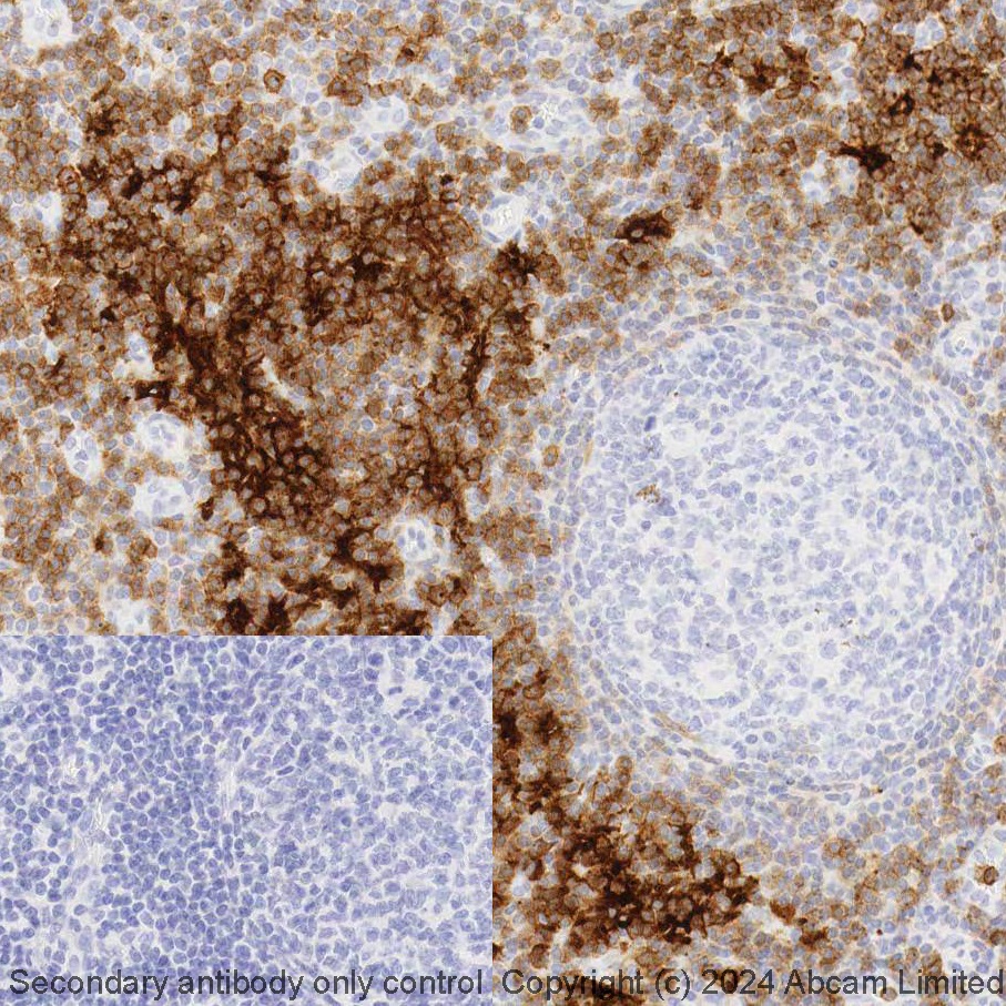 Immunohistochemistry (Formalin/PFA-fixed paraffin-embedded sections) - LBS RX - Anti-CCR7 antibody [EPR23192-57] (AB321957), expandable thumbnail