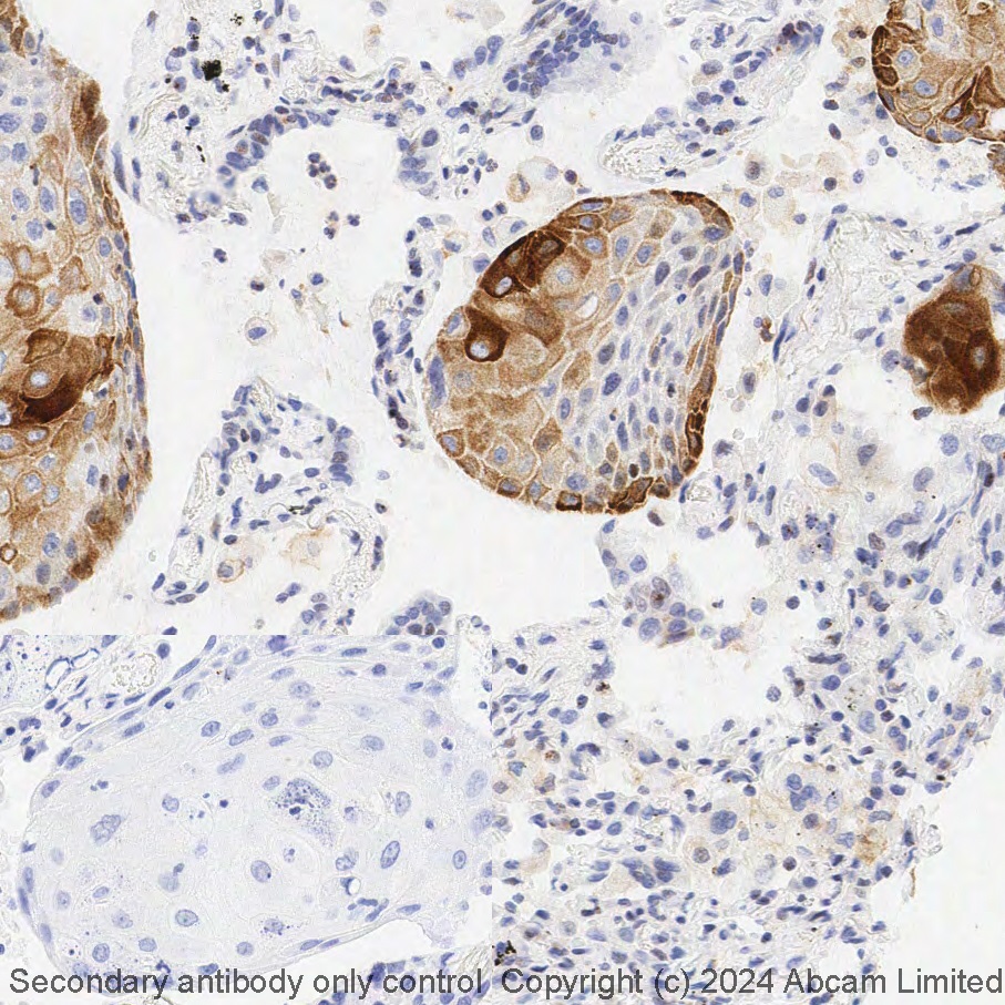 Immunohistochemistry (Formalin/PFA-fixed paraffin-embedded sections) - LBS RX - Anti-CXCR4 antibody [UMB2] (AB321952), expandable thumbnail