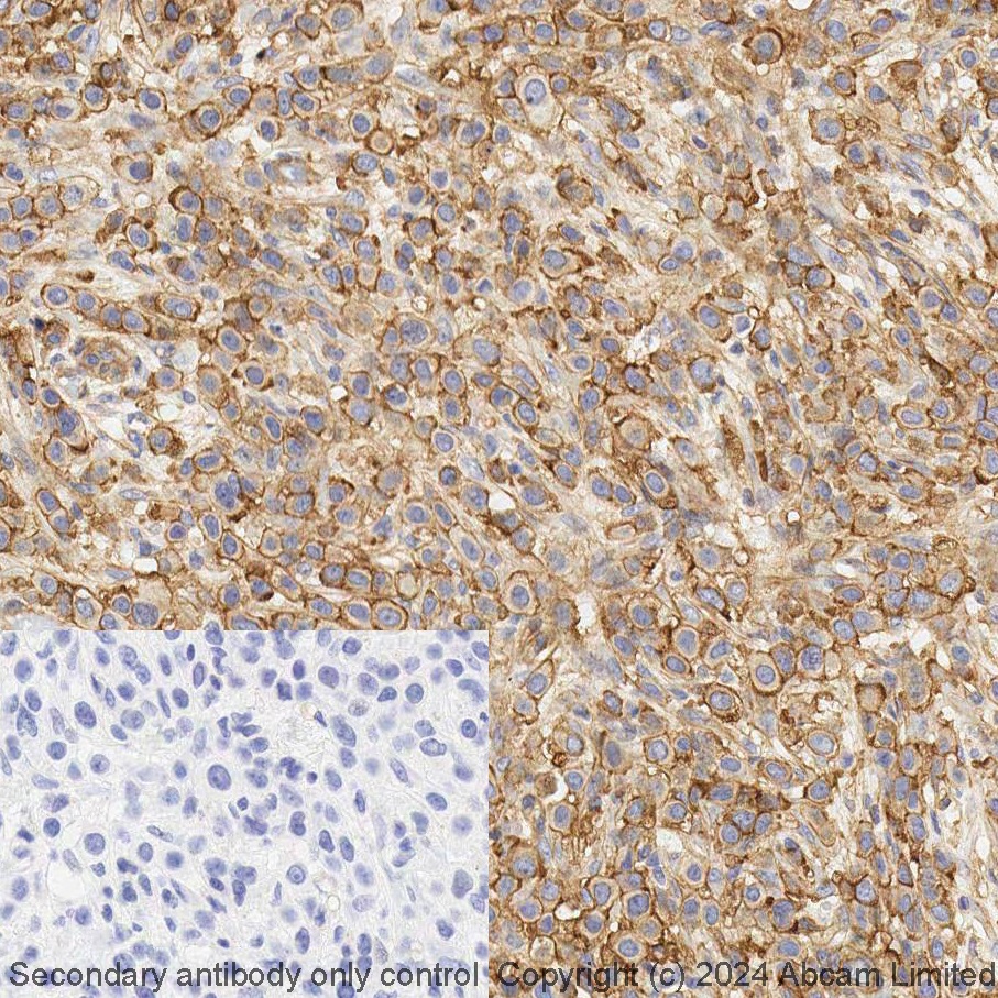 Immunohistochemistry (Formalin/PFA-fixed paraffin-embedded sections) - LBS RX - Anti-Met (c-Met) antibody [EPR19067] (AB321956), expandable thumbnail