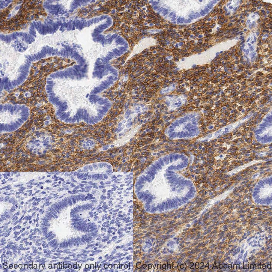 Immunohistochemistry (Formalin/PFA-fixed paraffin-embedded sections) - LBS RX - Anti-PDGFR alpha antibody [EPR22059-270] (AB321954), expandable thumbnail