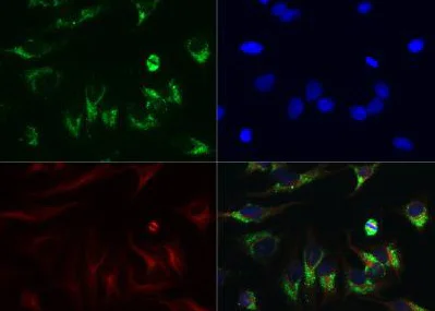 Immunocytochemistry/ Immunofluorescence - Anti-LC3B antibody (AB51520)