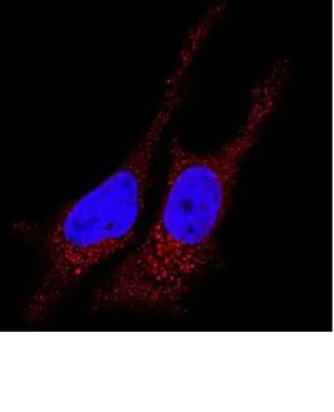 Immunocytochemistry/ Immunofluorescence - Anti-LC3B antibody (AB51520)