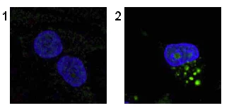 Immunocytochemistry/ Immunofluorescence - Anti-LC3B antibody (AB51520)