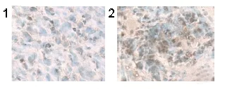 Immunohistochemistry (Frozen sections) - Anti-LC3B antibody (AB51520)