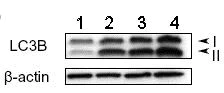 Western blot - Anti-LC3B antibody (AB51520)