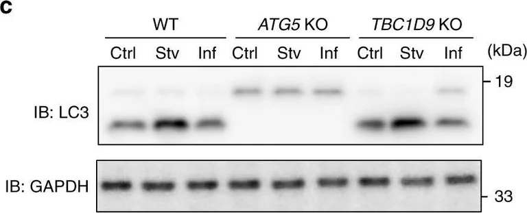 Western blot - Anti-LC3B antibody (AB51520)