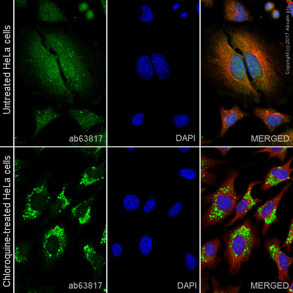 Immunocytochemistry/ Immunofluorescence - Anti-LC3B antibody (AB63817), expandable thumbnail