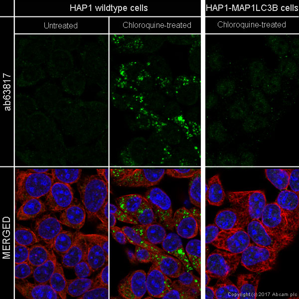 Immunocytochemistry/ Immunofluorescence - Anti-LC3B antibody (AB63817), expandable thumbnail