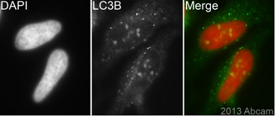 Immunocytochemistry/ Immunofluorescence - Anti-LC3B antibody (ab63817), expandable thumbnail