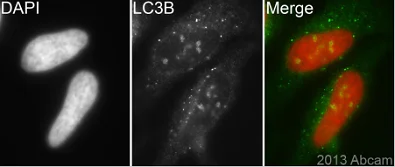 Immunocytochemistry/ Immunofluorescence - Anti-LC3B antibody (AB63817)
