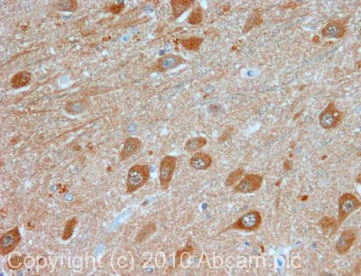Immunohistochemistry (Formalin/PFA-fixed paraffin-embedded sections) - Anti-LC3B antibody (AB63817)