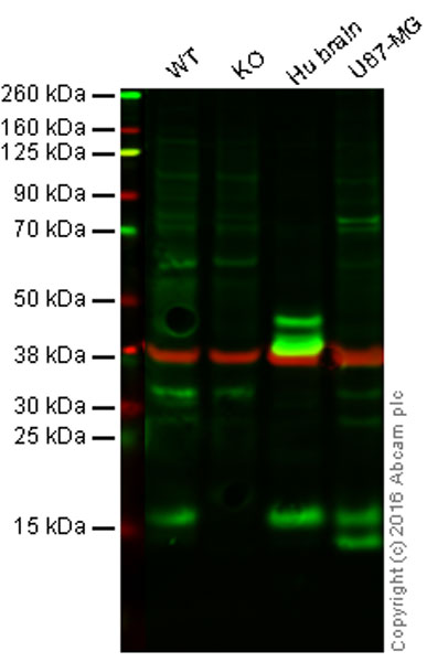 Western blot - Anti-LC3B antibody (AB63817), expandable thumbnail