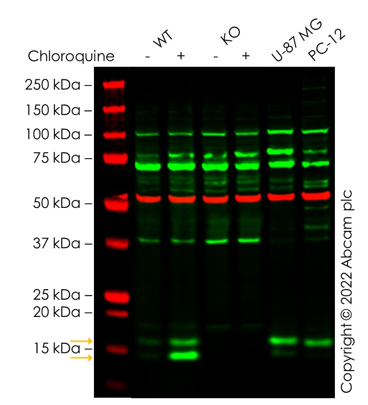 Western blot - Anti-LC3B antibody (ab63817), expandable thumbnail