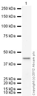 Western blot - Anti-LC3B antibody (ab63817), expandable thumbnail