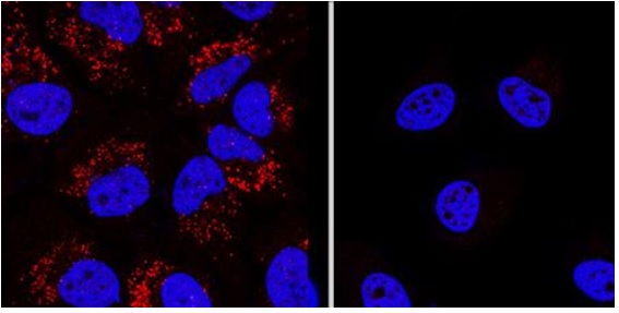 Immunocytochemistry/ Immunofluorescence - Anti-LC3B antibody - Autophagosome Marker (AB48394), expandable thumbnail