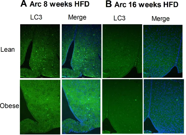 Immunohistochemistry (Formalin/PFA-fixed paraffin-embedded sections) - Anti-LC3B antibody - Autophagosome Marker (AB48394)