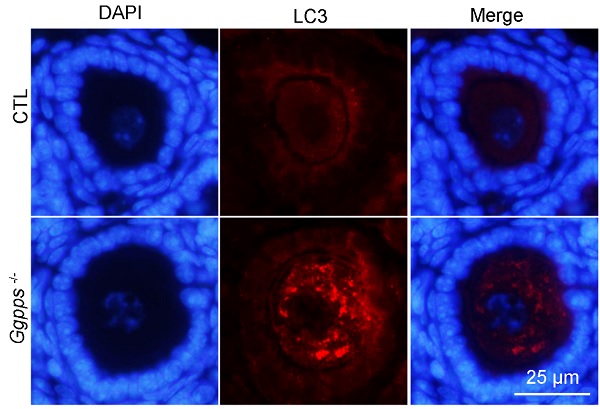 Immunohistochemistry (Formalin/PFA-fixed paraffin-embedded sections) - Anti-LC3B antibody - Autophagosome Marker (AB48394), expandable thumbnail