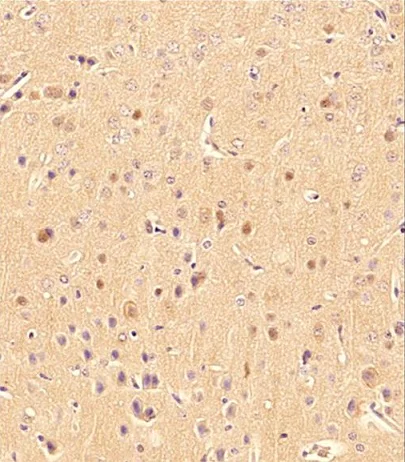Immunohistochemistry (Formalin/PFA-fixed paraffin-embedded sections) - Anti-LC3B antibody - Autophagosome Marker (AB48394)