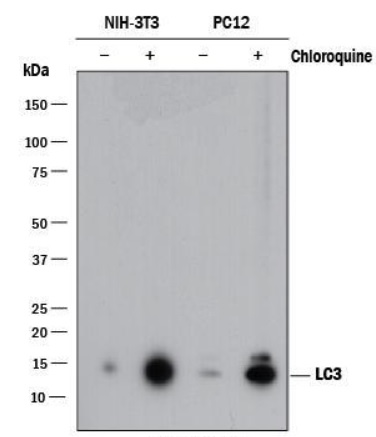 Western blot - Anti-LC3B antibody - Autophagosome Marker (ab48394), expandable thumbnail