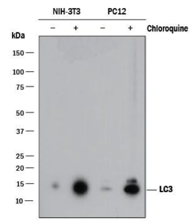 Western blot - Anti-LC3B antibody - Autophagosome Marker (AB48394)