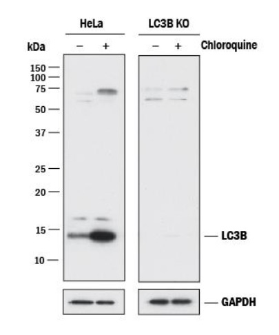 Western blot - Anti-LC3B antibody - Autophagosome Marker (AB48394), expandable thumbnail