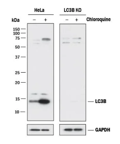 Western blot - Anti-LC3B antibody - Autophagosome Marker (AB48394)
