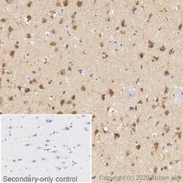 Immunohistochemistry (Formalin/PFA-fixed paraffin-embedded sections) - Anti-LC3B antibody [EPR18709] - Autophagosome Marker (AB192890)