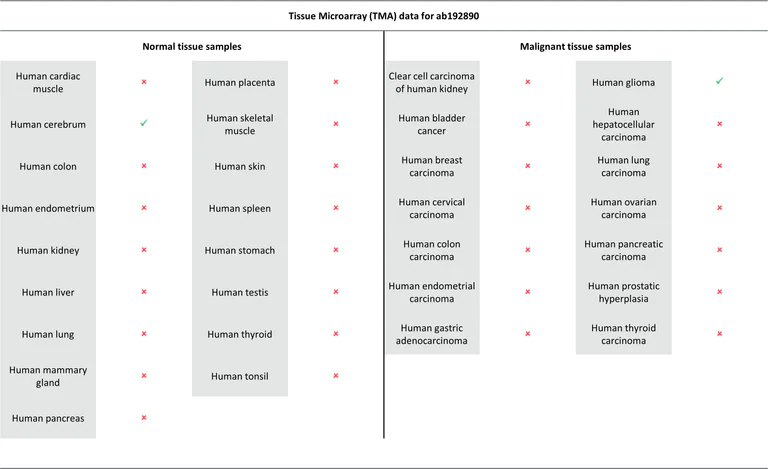 Immunohistochemistry (Formalin/PFA-fixed paraffin-embedded sections) - Anti-LC3B antibody [EPR18709] - Autophagosome Marker (AB192890)