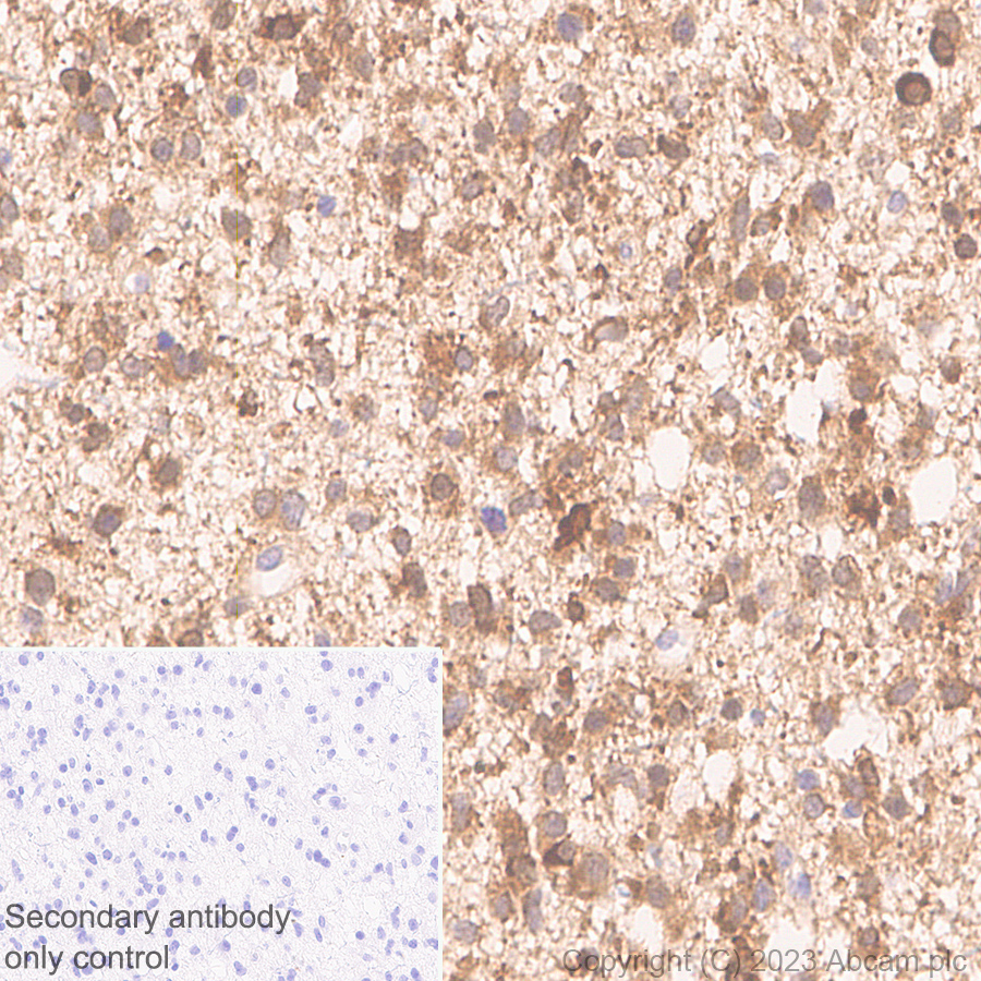 Immunohistochemistry (Formalin/PFA-fixed paraffin-embedded sections) - Anti-LC3B antibody [EPR18709] - Autophagosome Marker (ab192890), expandable thumbnail