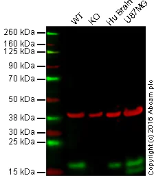 Western blot - Anti-LC3B antibody [EPR18709] - Autophagosome Marker (AB192890)